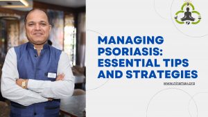 Managing Psoriasis: Essential Tips and Strategies