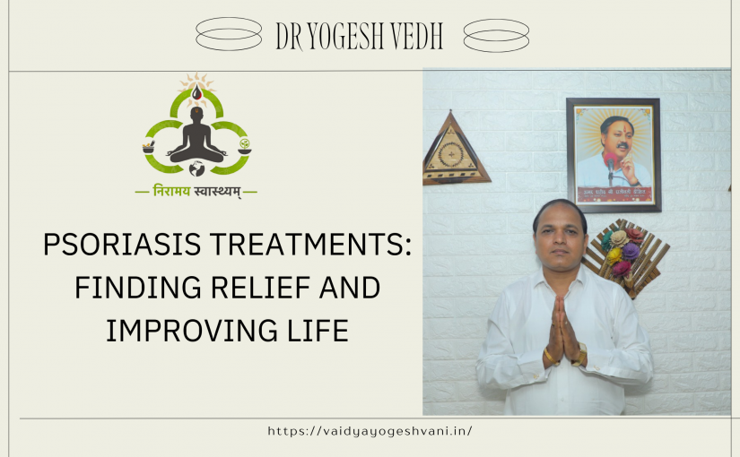 Psoriasis Treatment: Finding Relief and Improving Life