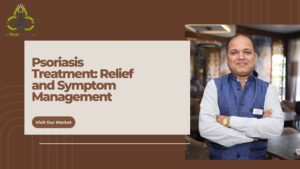 Psoriasis Treatment: Relief and Symptom Management