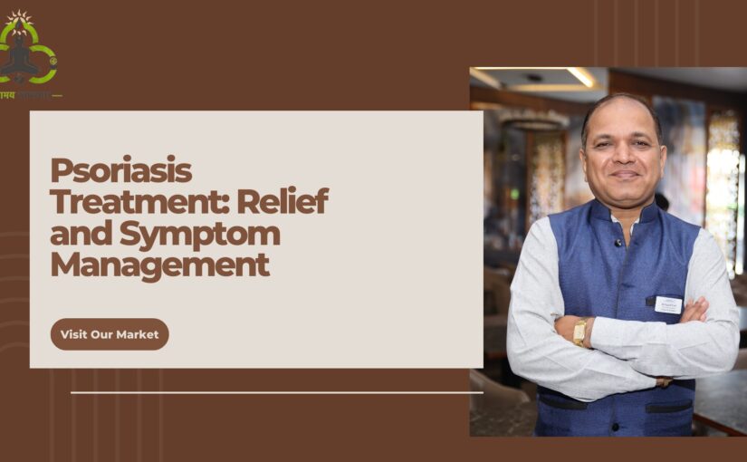 Psoriasis Treatment: Relief and Symptom Management