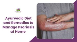 Ayurvedic Diet and Remedies to Manage Psoriasis at Home – Dr. Yogesh Vani