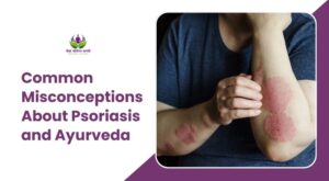 Common Misconceptions About Psoriasis and Ayurveda