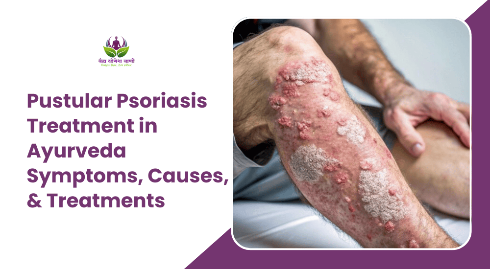 Pustular Psoriasis Treatment in Ayurveda: Symptoms & Causes