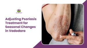 Adjusting Psoriasis Treatment for Seasonal Changes in Vadodara