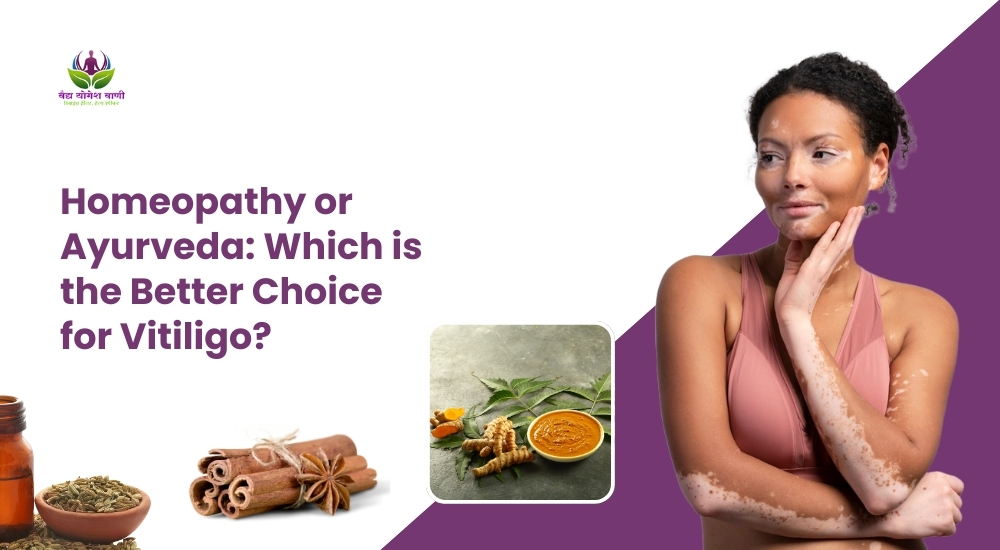 Homeopathy or Ayurveda: Which is the Better Choice for Vitiligo