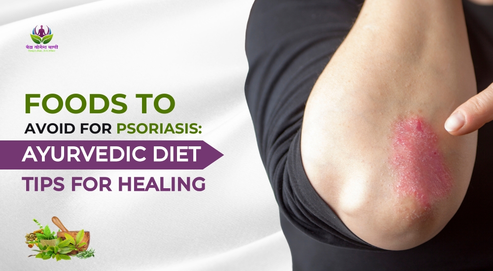 Foods to Avoid for Psoriasis