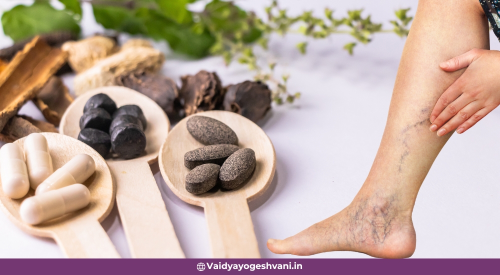 Best 5 Ayurvedic Remedies to Improve vein strength
